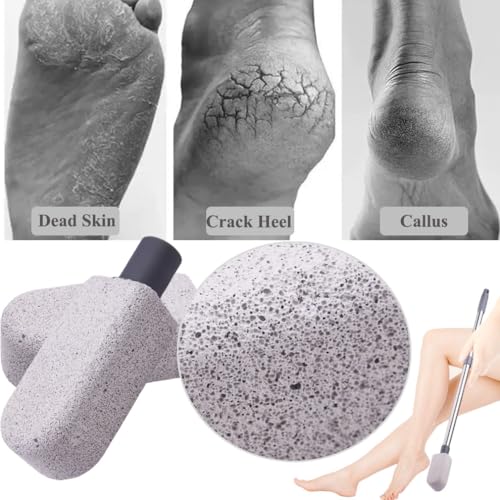 Pumice Stone for Feet, Foot Dead Skin Scrubber with 30" Long Handle Set, Feet File Callus Remover for Exfoliation, Foot Scrub Shower Pedicure Tools Foot Care Stone