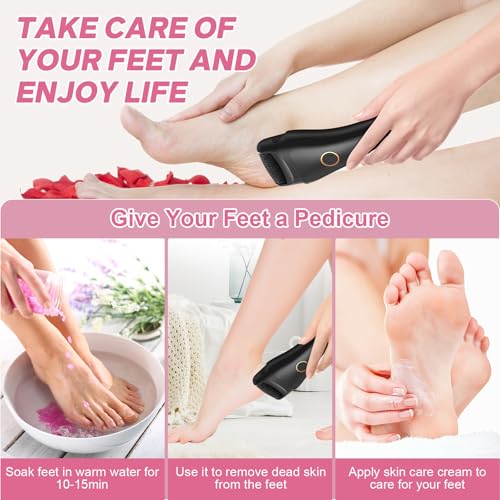 Electric Foot File - Callus Remover for Feet, Adjustable 3 Speed Foot Callus Remover with 16 in 1 Pedicure Tools Professional Foot Care, to Remove Dead Skin and Calluses Hard Skin Dry Cracks (Black)