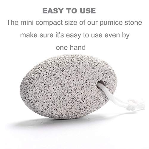 Natural Foot Pumice Stone for Feet, Borogo 5-Pack Lava Pedicure Tools Hard Skin Callus Remover for Feet and Hands - Natural Foot File Exfoliation to Remove Dead Skin, Heels, Elbows, Hands