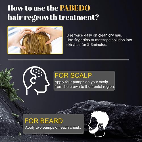 5% Minoxidil Hair Growth Serum, Minoxidil Spray For Beard Growth Serum, Hair Growth oil Spray, Treating Hair Loss For Thicker Longer Fuller Healthier Hair, 3.38 Oz