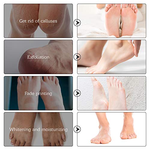 Foot Mask for Dry Cracked Feet, 3 Pairs Feet Peeling Mask, Foot Masks That Remove dead Skin, Callus Remover, Dry, Cracked Skin, Intensely Moisturizes Repairs, Spa Experience, Natural Exfoliator