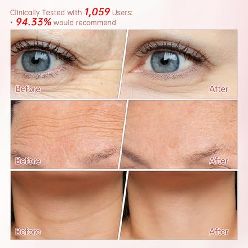 Peunitory Eye Balm Stick,Under Eye Cream Anti-Wrinkle Firming Treatment | Dark Circle Brightener | Hydrating (0.32oz)