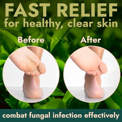 Foot Scrub with Tea Tree Oil | Callus Remover For Feet | Exfoliating Scrub with Salicylic and Glycolic Acid for Dead Skin, Athlete¡¯s Foot, Warts, Corns, Rashes, Foot Odor, Insect Bites and Foot Care