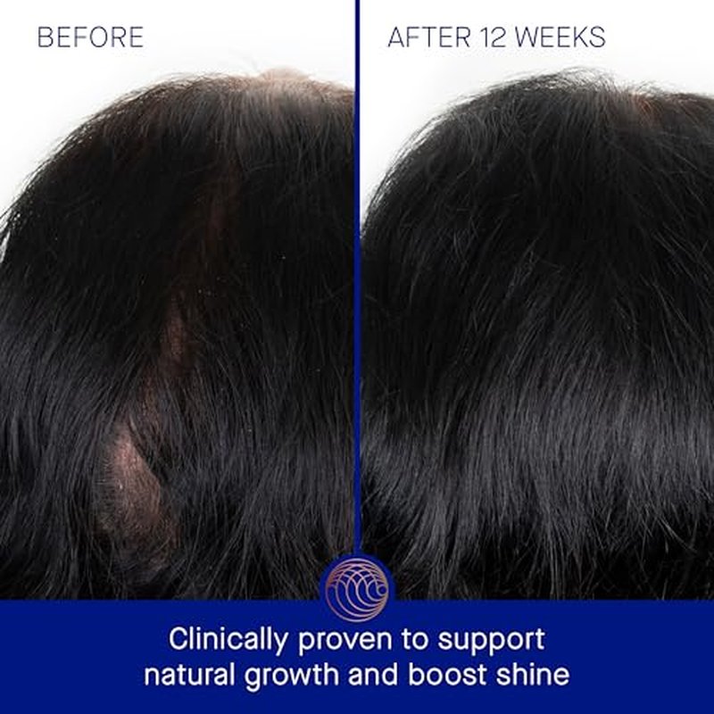 Augustinus Bader The Scalp Treatment