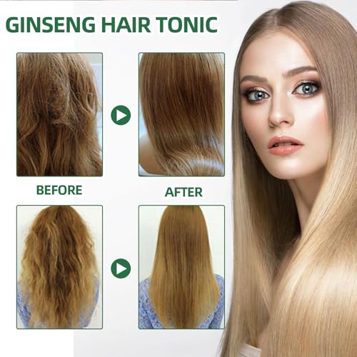 Hair Growth Spray, OUHOE Tonico Para Crecimiento Del Cabello, Natural Herbs Ginseng Hair Tonic, Generic Stronger and Hair Thickening, Non-greasy Nourishing Hair Mist for Women & Men (2Pcs)