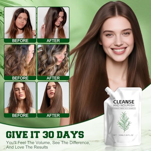Rosemary Amino Acid Shampoo,Hair Growth Shampoo for Thinning Hair Women and Men Hair Loss£¬Strengthen Scalp with Natural formula- 2 Packs
