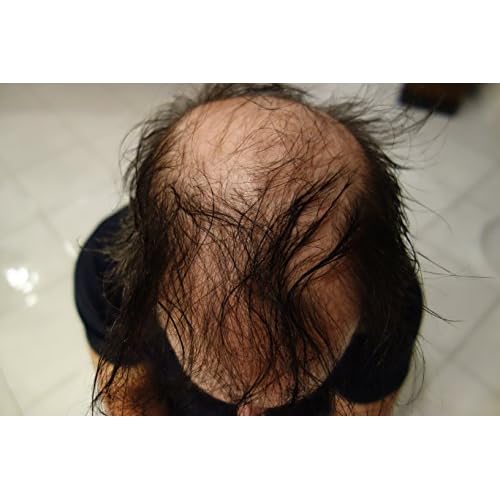 Hair Building Fibers 57 Grams. Highest Grade Refill That You Can Use for Your Bottles From Competitors Like Toppik?, Xfusion?, Miracle Hair? (Dark Brown) Please see pics - we have 2 dark brown shades