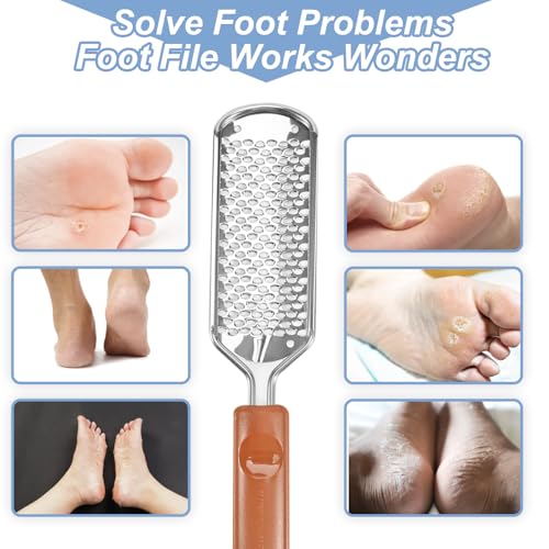 Professional Foot Scrubber Dead Skin Remover, Pedicure Foot File Callus Removal, Heel Scraper for Cracked Heels, Microplane Cheese Grater for Feet, Foot Rasp for Hard Skin(T1)