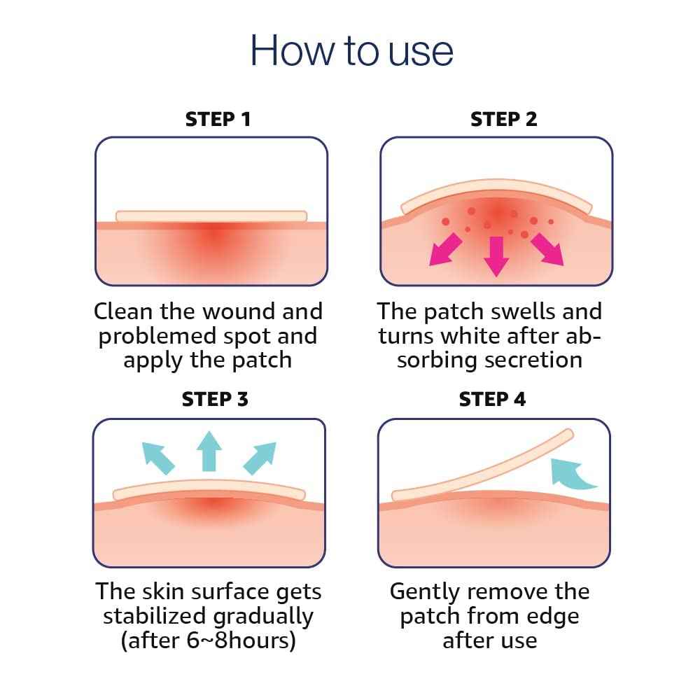 OLIVE YOUNG | Care Plus Spot Patch 1 Pack (102 Count - 10mm*72ea + 12mm*30ea) + Care Plus Large Size Korean Spot Pimple Patches 1Pack (81 Count - 12mm*45ea + 14mm*36ea)