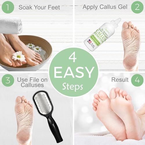 Dr. Entre's Callus Remover Gel & Foot File: Extra Strength Callus Remover for Feet, Foot Callus Remover Care, Pedicure Tools Supplies, Spa Kit, Dead Skin Scrubber, 4 oz
