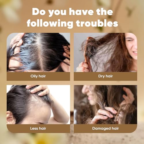 Dekohair Hair Regrowth Serum, Scalp Serum for Hair Growth, Protect Hair Follicles & Inhibit Hair Loss, Thickening and Healthier Scalp for Men & Women 2 Fl Oz (1)