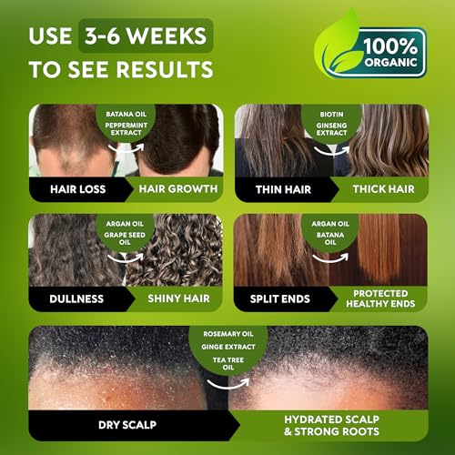 Batana Oil Shampoo for Hair Growth - Routine Shampoo for Thinning Hair for Women & Men - 9-in-1 Natural Hair Loss Shampoo with Biotin, Rosemary Oil - Thickening Hair Treatment & Regrowth