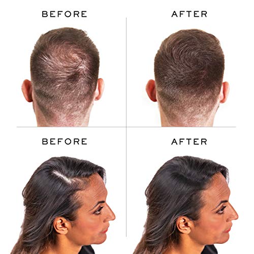 Nanogen Keratin Hair Fibers,, 30-grams, Light Brown