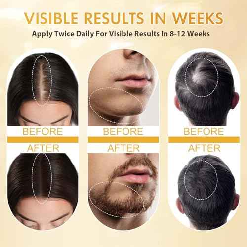 Minoxidil for Men and Women, Hair Growth Biotin Serum with Batana and Rosemary for Hair Beard Regrowth Treatments Extra Strength Hair Loss Solution, Clinically Proven to Regrow Thicker