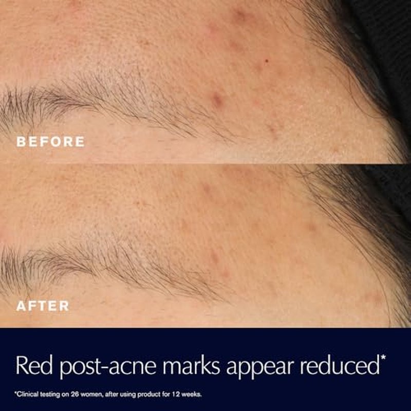 Est?e Lauder Advanced Night Repair Rescue Solution with 15% Bifidus Ferment to Reduce Visible Redness, 0.68 Fl Oz