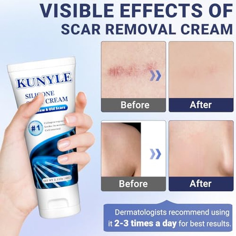 Scar Cream, Silicone Scar Gel, Advanced Scar Removal Cream for Surgical Scars, Stretch Marks Removal, Keloid Bump Removal, Old and New Scars 2.11 Oz (60g)