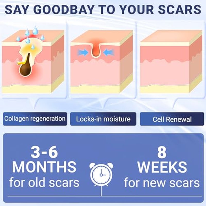 Scar Cream, Silicone Scar Gel, Advanced Scar Removal Cream for Surgical Scars, Stretch Marks Removal, Keloid Bump Removal, Old and New Scars 2.11 Oz (60g)