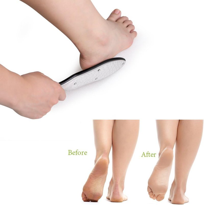 Professional Foot File Callus Remover - Double-Sided Pedicure Rasp for Cracked Heels & Dead Skin | Heavy-Duty Stainless Steel with Storage Bag & Gift Box
