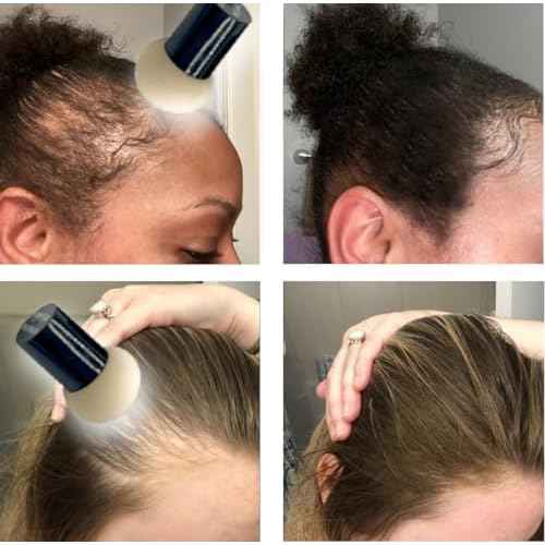 KERATIN RESEARCH Hairline Filler Unisex Mineral Powder Root Touch-Up Hair loss Concealer Scalp & Beard Bald Patch Coverage Fibers for Thinning Hair Waterproof Organic Natural look (DARK ASH BROWN, XL)