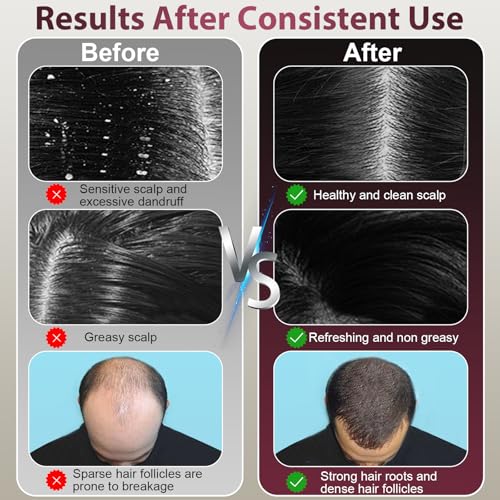 Laser Therapy Hair Growth Comb, Hair Oil Applicator,Electric Scalp Massager Hair Growth with IPX7 Waterproof