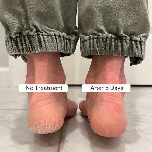 Pedestrian Project Cracked Heel Repair Foot Care Balm, Smooths & Fills Cracks & Rough Skin with Healing Shea & Mango Butters, Vegan, Cruelty Free, 1 oz