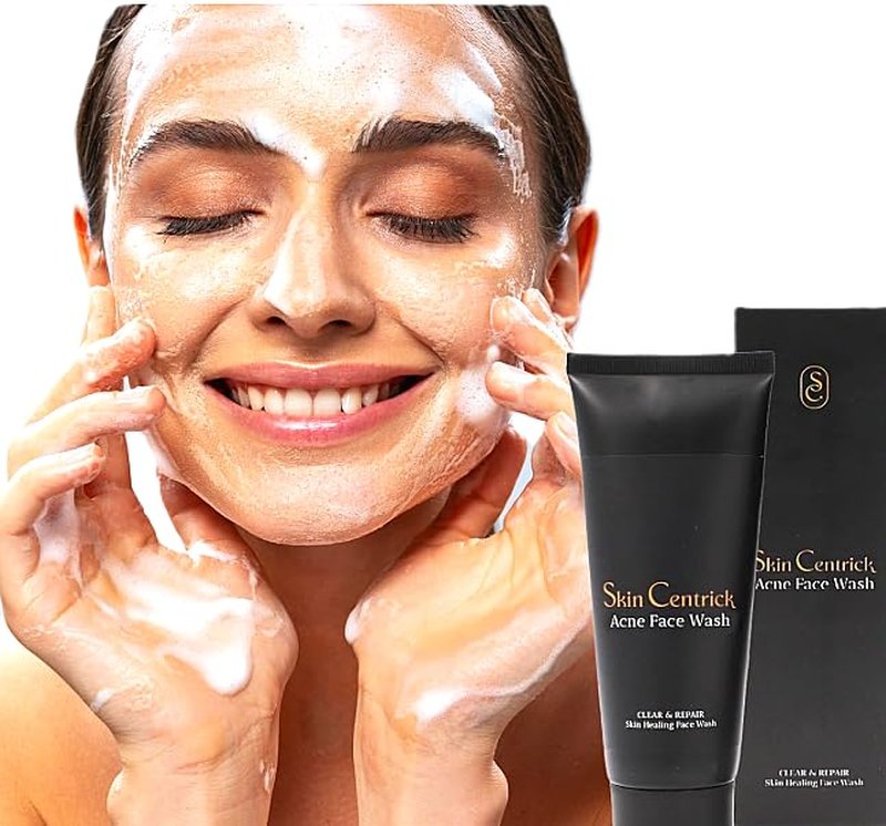 Clarifying Acne Control Face Cleanser - Salicylic Acid & Niacinamide for Oily Skin | Unclogs Pores, Fights Breakouts