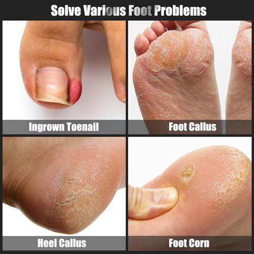 7-Piece Ingrown Toenail Treatment Set, Professional Stainless Steel Ingrown Toenail Removal Kit, Calloused Feet Remover Tool, Manicure Treatment Pedicure Tools for Feet (Under-Nail Clean + Foot Care)