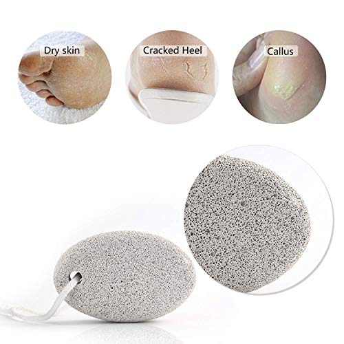 Natural Pumice Stone for Feet 2 PCS, PHOGARY Lava Pedicure Tools Hard Skin Callus Remover for Feet and Hands - Natural Foot File Exfoliation to Remove Dead Skin