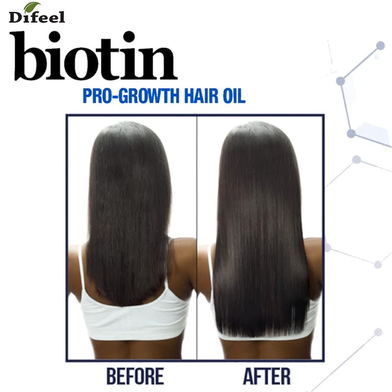 Difeel Biotin Hair Oil - Nourishing Formula for Healthy Hair Growth | 7.1 oz (Pack of 4)