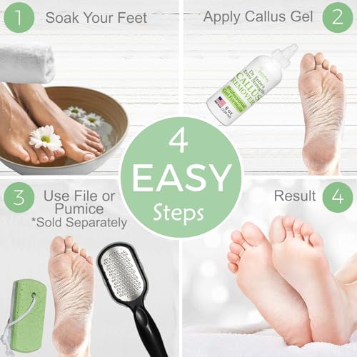Dr. Entre's Callus Remover Gel: 8oz Extra Strength with Precision Applicator, Callus Remover for Feet, Foot Callus Remover, Foot Care, Pedicure Tools Supplies, Dead Skin Remover