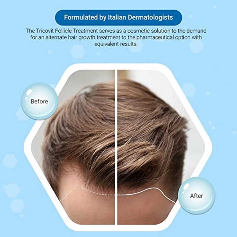 Tricovit Forte Hair Loss Treatment - Hair Growth Products for Women & Men Developed by Dermatologists - DHT Blocker & Sebum Regulator for Strengthening Follicles & Balancing Scalp (10 Ampoules)