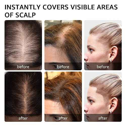 Instantly Hairline powder, Root touch up hair color for gray coverage, hair powder for women men bald spot loss and thin concealing£¨Dark Brown)