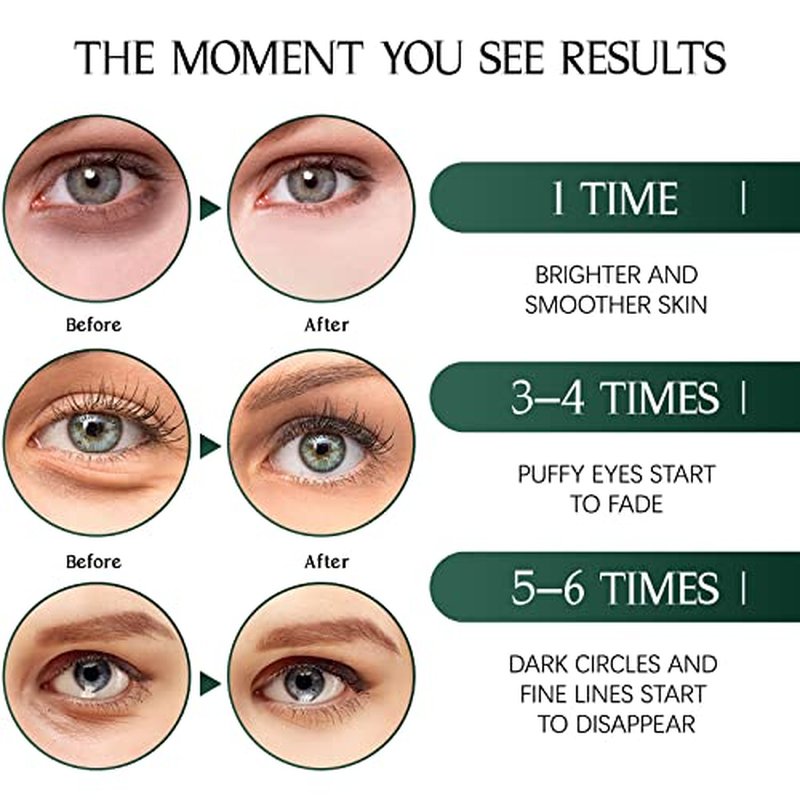 Tiepetly Under Eye Masks with Collagen, Green Tea Eye Patches for Dark Circles and Puffiness, Hydrating, Anti Wrinkle, 60 pcs