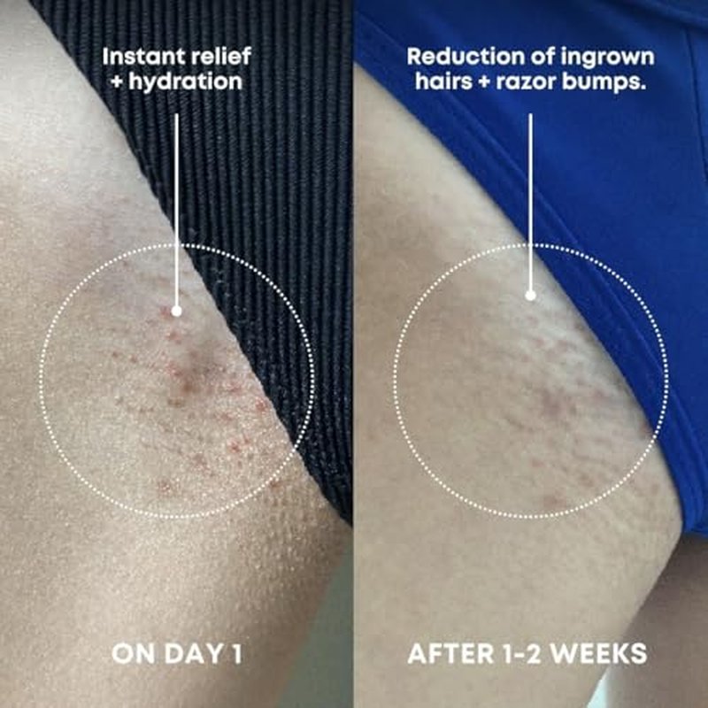 Bushbalm Ingrown Hair Exfoliating Scrub ? Pre-Shave Sugar Scrub for Ingrown Hairs, Razor Bumps & Dry Skin ? Gently Buffs & Soothes Sensitive Skin ? Nude, 236ml
