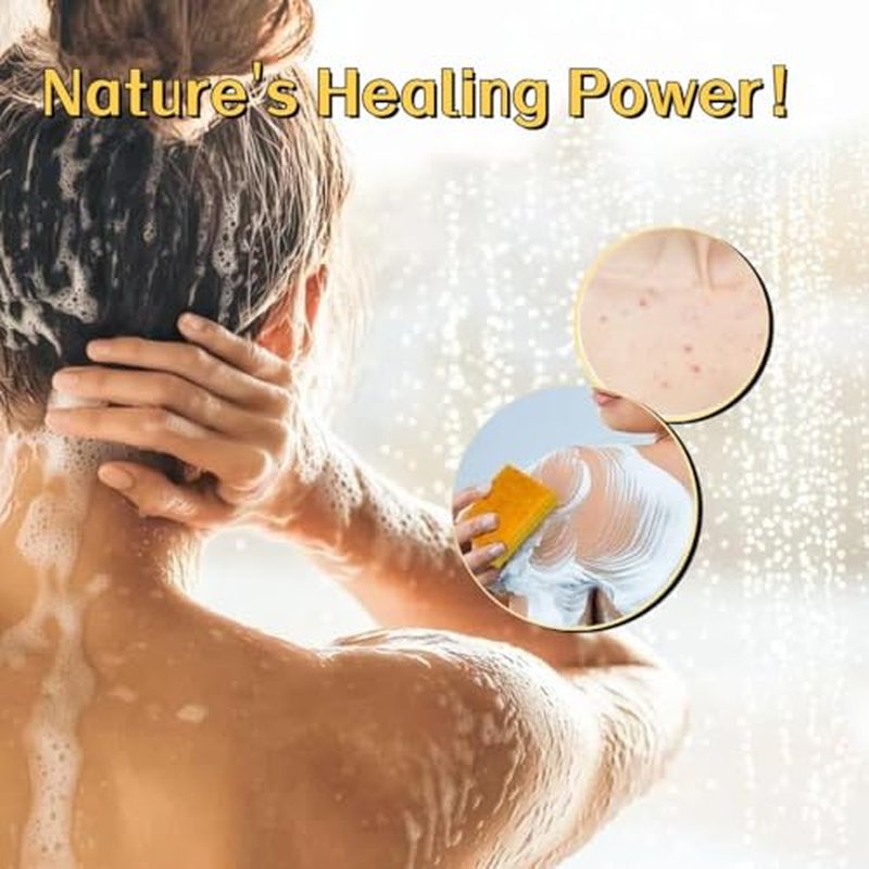 Kojic Acid & Turmeric Soap Bar for Dark Spot removal - Skin Lightening Soap with Vitamin C, Retinol, Shea Butter & Lemon Oil - for Face, Body, Underarms - SLS Free, for Oily & Dry Skin