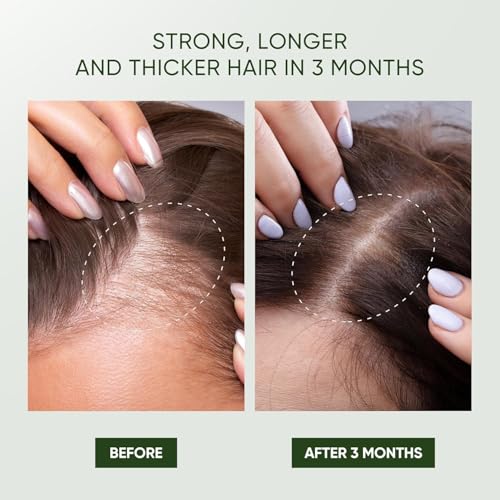 Svvimer Rosemary Hair Growth Shampoo - Thickening Shampoo with Biotin Tea Tree Oil Mint for Hair Loss and Thinning Hair - for Women and Men 11.8 Fl Oz (Pack of 1)