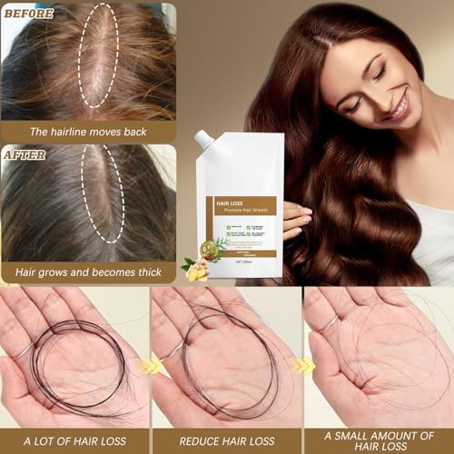 Anti-Hair Fall Hair Loss Shampoo 2 Pack, Promote Hair Growth Shampoo, Rich in Various Plant Extracts, for All Hair Types (300ml x 2 Bottles)