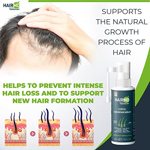 Transplant Clinical Repair Serum - 60ml Hair Regrowth Serum - Prevents Post-Transplant Hair Loss - Stimulates New Hair Growth - Fast and Effective Results - Gentle Formula