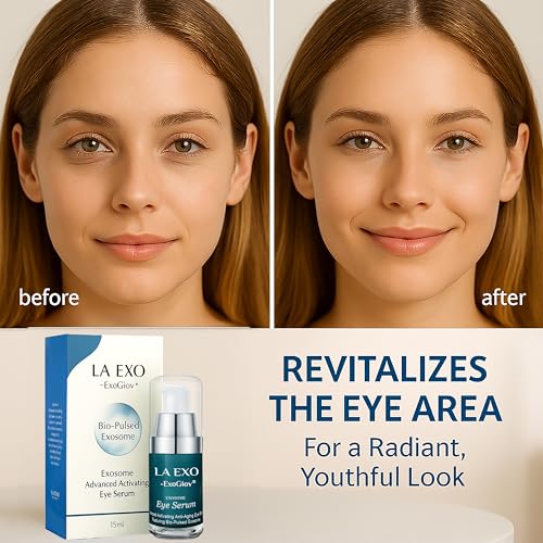 Exosome Eye Serum ? Advanced Anti-Aging Eye Treatment for Puffiness, Dark Circles & Fine Lines ? Brightening, Smoothing & Hydrating Undereye Skin Care for a Youthful Look ? 15ml