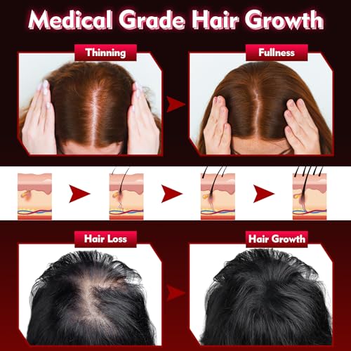 Hair Growth Device - FDA Cleared - UUPAS Professional Laser Diodes Red Light Therapy Hair Growth Cap System for Hair Regrowth, Alopecia - Hair Growth Treatments Products for Men Women