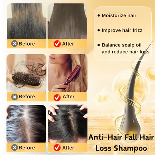 2Pcs Anti-Hair Fall Hair Loss Shampoo,Anti-Hair Fall Promote Hair Growth Shampoo, Rich in Various Plant Extracts Moisturize hair,Suitable For All Hair Type