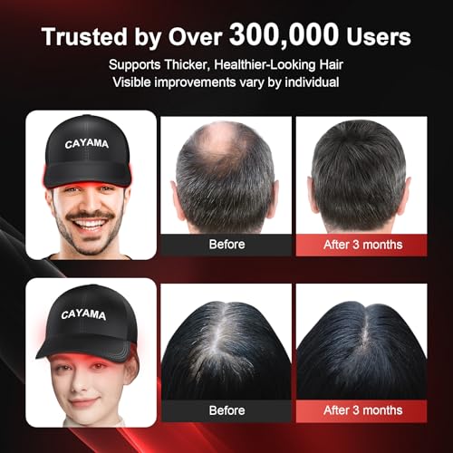 CAYAMA Red Light Therapy Cap for Hair ? 510 LEDs Laser Hair Cap for Fuller, Healthier-Looking Hair, Light-Based Care Device for Men & Women
