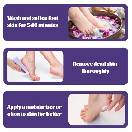 6 Pcs Foot Pumice Stone Scrubber Professional Pedicure Ped File Scrubber Exfoliating Rock Pumice Stone for Smooth Feet and Heels Callus Removal and Dead Skins