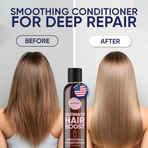 Moerie Ultimate Hair Growth Conditioner ? For Longer, Thicker, Fuller Hair - Vegan Friendly Volumizing Hair Products ? Paraben & Silicone Free ? All Hair Types ? Reverse Hair Loss ? 8.45 fl oz (250ml)