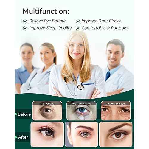 30PCS Steam Eye Masks for Dry Eyes & Fatigue Relief, Self-Heating Eye Mask for Puffiness & Dark Circles, Moist Heat Compress, Travel-Friendly, No Microwave Needed, Spa Relaxation for Women, Unscented