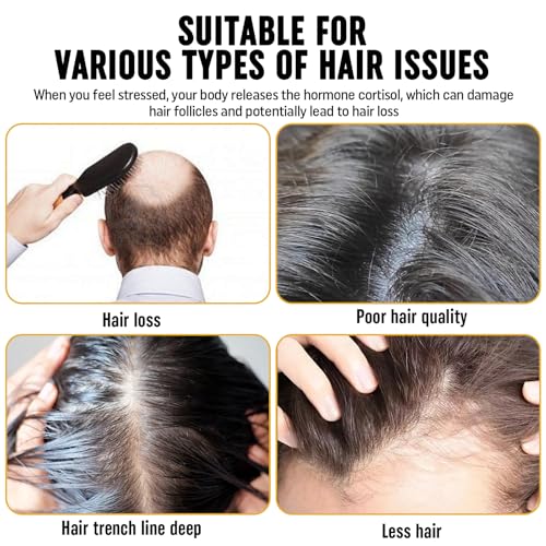 2Pcs Root Activator Shampoo - Hair Growth Root Activator Shampoo for Men and Women - Natural Formula for Hair Loss and Thinning Hair