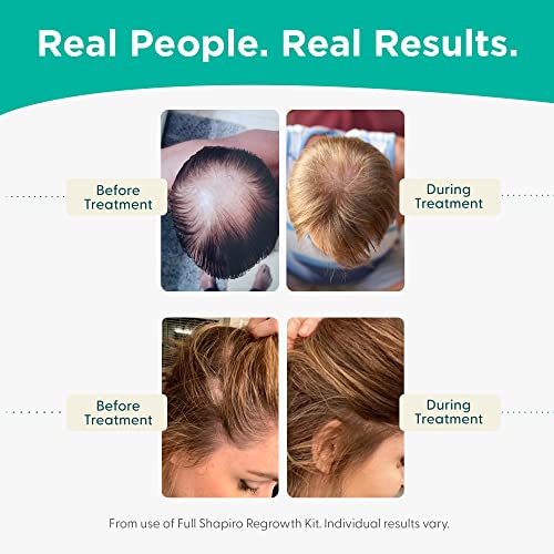 Shapiro MD Hair Growth Experts Vegan Hair Loss Shampoo for Thinning Hair | Experience Healthier, Fuller and Thicker Looking Hair (1 Month Supply)