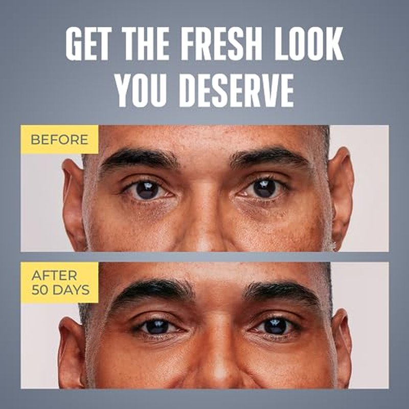 Mens Eye Cream - Eye Bags Treatment for Men & Wrinkle Reduction | Collagen, Vitamin B3, Peptides, 5% Caffeine ? Mens Under Eye Cream Bag Remover ? Puffy Eyes Treatment for Men