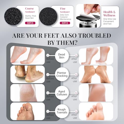 krofaue 1000RPM Electric Callus Remover - Professional Aluminum Foot File Adjustable Pedicure Tool with 60pcs Sandpaper Discs for Dead Skin at Home