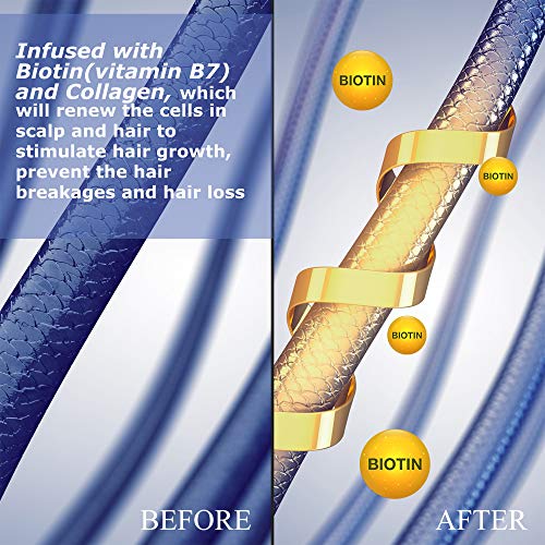 Luseta Biotin & Collagen Conditioner Thickening for Hair Loss & Fast Hair Growth - Infused with Argan Oil to Repair Damaged Dry Hair - Sulfate Free Paraben Free 33.8oz